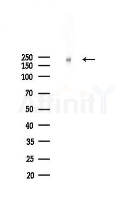 ABCC1 Recombinant Rabbit mAb - Western blot analysis of lysates from A2780 cells(starvation 24h treatment), using ABCC1 Recombinant Rabbit mAb at 1/1000 dilution.