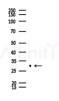 GCLM Recombinant Rabbit mAb - Western blot analysis of lysates from LoVo cells(heat-shock,45min treatment), using GCLM Recombinant Rabbit mAb at 1/1000 dilution.