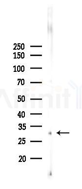 GCLM Recombinant Rabbit mAb - Western blot analysis of lysates from B16F10-LUC cells(heat-shock,45min treatment), using GCLM Recombinant Rabbit mAb at 1/1000 dilution.