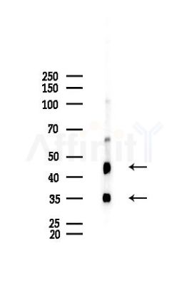 Carbonic Anhydrase 9/CA9 Recombinant Rabbit mAb - Western blot analysis of lysates from Mouse liver, using Carbonic Anhydrase 9/CA9 Recombinant Rabbit mAb at 1/1000 dilution.