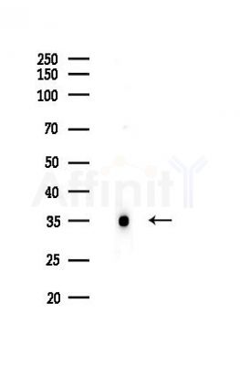 Carbonic Anhydrase 9/CA9 Recombinant Rabbit mAb - Western blot analysis of lysates from HUVEC cells(LPS 4h treatment), using Carbonic Anhydrase 9/CA9 Recombinant Rabbit mAb at 1/1000 dilution.