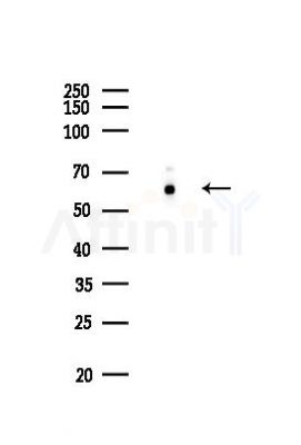 FTO Recombinant Rabbit mAb - Western blot analysis of lysates from EC304 cells(LPS,4h treatment), using FTO Rabbit mAb at 1/1000 dilution.
