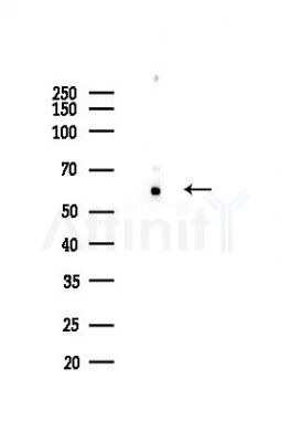 FTO Recombinant Rabbit mAb - Western blot analysis of lysates from A375 cells(heat-shock,45min treatment), using FTO Rabbit mAb at 1/1000 dilution.