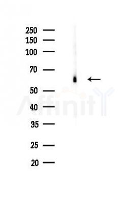 FTO Recombinant Rabbit mAb - Western blot analysis of lysates from Rat testis, using FTO Rabbit mAb at 1/1000 dilution.