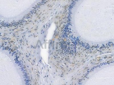 FTO Recombinant Rabbit mAb - BF3679 at 1/100 staining human testicular cancer by IHC-P.