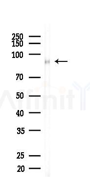 Integrin beta 5 Recombinant Rabbit mAb - Western blot analysis of lysates from Rat brain, using Integrin beta 5 Recombinant Rabbit mAb at 1/1000 dilution.