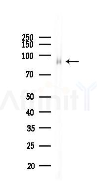 Integrin beta 5 Recombinant Rabbit mAb - Western blot analysis of lysates from Mouse liver, using Integrin beta 5 Recombinant Rabbit mAb at 1/1000 dilution.