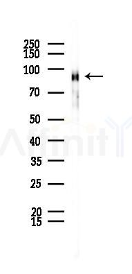 Integrin beta 5 Recombinant Rabbit mAb - Western blot analysis of lysates from LoVo cells(heat-shock,45min treatment), using Integrin beta 5 Recombinant Rabbit mAb at 1/1000 dilution.