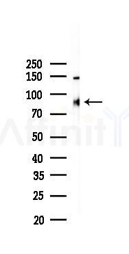 Integrin beta 5 Recombinant Rabbit mAb - Western blot analysis of lysates from B16F10-LUC cells(heat-shock,45min treatment), using Integrin beta 5 Recombinant Rabbit mAb at 1/1000 dilution.