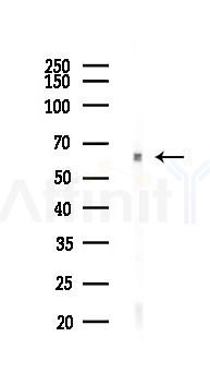 ELK1 Recombinant Rabbit mAb - Western blot analysis of lysates from Rat spleen, using ELK1 Recombinant Rabbit mAb at 1/1000 dilution.