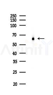ELK1 Recombinant Rabbit mAb - Western blot analysis of lysates from Hela cells(LPS,4h treatment), using ELK1 Recombinant Rabbit mAb at 1/1000 dilution.