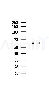 ELK1 Recombinant Rabbit mAb - Western blot analysis of lysates from HUVEC cells(LPS,4h treatment), using ELK1 Recombinant Rabbit mAb at 1/1000 dilution.