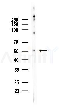 GSS Recombinant Rabbit mAb - Western blot analysis of lysates from B16F10-LUC cells(LPS, 4h treatment), using Glutathione Synthetase Recombinant Rabbit mAb at 1/1000 dilution.