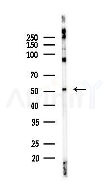 GSS Recombinant Rabbit mAb - Western blot analysis of lysates from COLO205 cells(heat-shock, 45min treatment), using Glutathione Synthetase Recombinant Rabbit mAb at 1/1000 dilution.