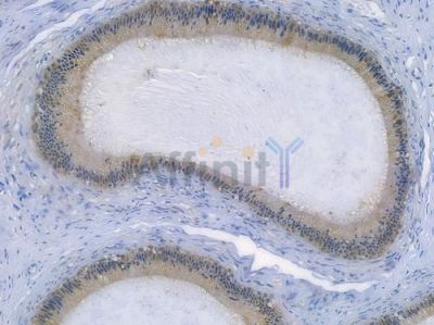 GSS Recombinant Rabbit mAb - BF3684 at 1/100 staining human testicular cancer by IHC-P.