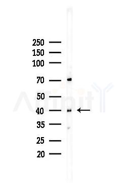 PDX1 Recombinant Rabbit mAb - Western blot analysis of lysates from COLO205 cells(heat-shock,45min treatment), using PDX1 Recombinant Rabbit mAb at 1/1000 dilution.