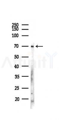 Optineurin Recombinant Rabbit mAb - Western blot analysis of lysates from Hela cells(LPS,4h treatment), using Optineurin Recombinant Rabbit mAb at 1/1000 dilution.