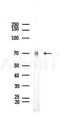 Optineurin Recombinant Rabbit mAb - Western blot analysis of lysates from Rat testis, using Optineurin Recombinant Rabbit mAb at 1/1000 dilution.