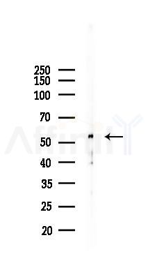 ATG12 Recombinant Rabbit mAb - Western blot analysis of lysates from Hela cells(LPS, 4h treatment), using Apg12 Recombinant Rabbit mAb at 1/1000 dilution.