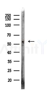 ALDH1A1 Recombinant Rabbit mAb - Western blot analysis of lysates from Rat testis, using ALDH1A1 Rabbit mAb at 1/1000 dilution.