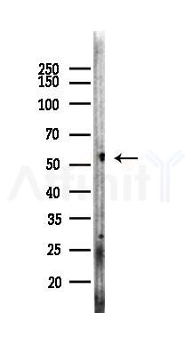 ALDH1A1 Recombinant Rabbit mAb - Western blot analysis of lysates from HepG2 cells(heat-shock,45min treatment), using ALDH1A1 Rabbit mAb at 1/1000 dilution.