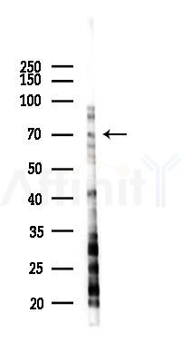 PMEL17 / GP100 Recombinant Rabbit mAb - Western blot analysis of lysates from Hela cells(LPS,4h treatment), using Melanoma gp100 Recombinant Rabbit mAb at 1/1000 dilution.