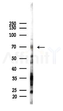 PMEL17 / GP100 Recombinant Rabbit mAb - Western blot analysis of lysates from Mouse testis, using Melanoma gp100 Recombinant Rabbit mAb at 1/1000 dilution.