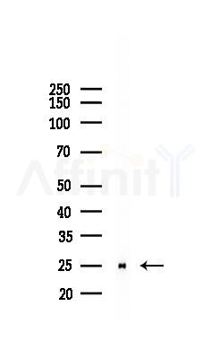 MFAP5 Recombinant Rabbit mAb - Western blot analysis of lysates from Rat kidney, using MAGP2 Recombinant Rabbit mAb at 1/1000 dilution.