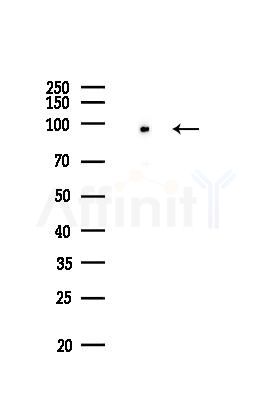 UHRF1 Recombinant Rabbit mAb - Western blot analysis of lysates from EC304 cells(LPS,4h treatment), using UHRF1 Rabbit mAb at 1/1000 dilution.