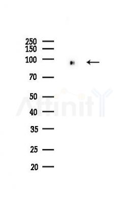 UHRF1 Recombinant Rabbit mAb - Western blot analysis of lysates from A375 cells(heat-shock,45min treatment), using UHRF1 Rabbit mAb at 1/1000 dilution.