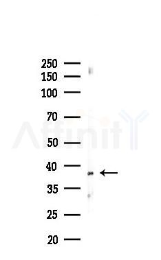 AQP2 Recombinant Rabbit mAb - Western blot analysis of lysates from Hela cells(heat-shock,45min treatment), using Aquaporin 2 Recombinant Rabbit mAb at 1/1000 dilution.