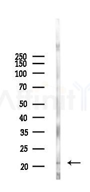 Claudin 7 Recombinant Rabbit mAb - Western blot analysis of lysates from Mouse lung, using Claudin 7 Recombinant Rabbit mAb at 1/1000 dilution.