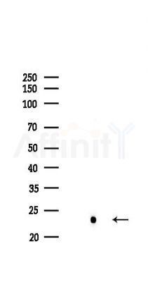 NRAS Recombinant Rabbit mAb - Western blot analysis of lysates from COLO205 cells(LPS,4h treatment), using RAS Recombinant Rabbit mAb at 1/1000 dilution.
