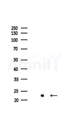 NRAS Recombinant Rabbit mAb - Western blot analysis of lysates from HepG2 cells(heat-shock,45min treatment), using RAS Recombinant Rabbit mAb at 1/1000 dilution.