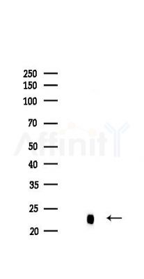 NRAS Recombinant Rabbit mAb - Western blot analysis of lysates from Mouse brain, using RAS Recombinant Rabbit mAb at 1/1000 dilution.