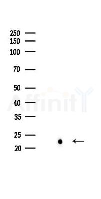 NRAS Recombinant Rabbit mAb - Western blot analysis of lysates from Rat lung, using RAS Recombinant Rabbit mAb at 1/1000 dilution.