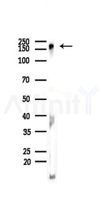 ACE1 Recombinant Rabbit mAb - Western blot analysis of lysates from Mouse testis, using Angiotensin Converting Enzyme 1 Recombinant Rabbit mAb at 1/1000 dilution.
