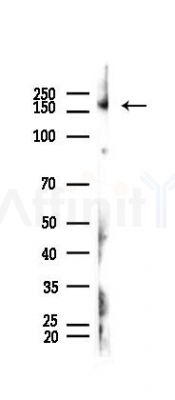 ACE1 Recombinant Rabbit mAb - Western blot analysis of lysates from Rat testis, using Angiotensin Converting Enzyme 1 Recombinant Rabbit mAb at 1/1000 dilution.