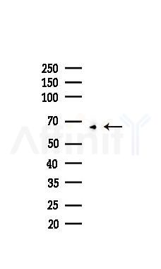 TCF4 Recombinant Rabbit mAb - Western blot analysis of lysates from COLO205 cells(heat-shock,45min treatment), using TCF4 Recombinant Rabbit mAb at 1/1000 dilution.