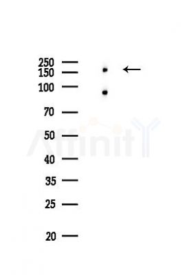 ITGA2 Recombinant Rabbit mAb - Western blot analysis of lysates from EC304 cells(LPS,4h treatment), using Integrin alpha 2 Rabbit mAb at 1/1000 dilution.