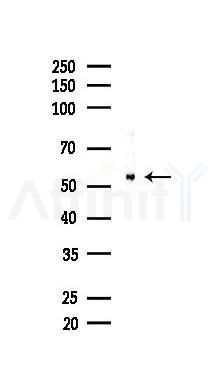NR1D1 Recombinant Rabbit mAb - Western blot analysis of lysates from HUVEC cells(LPS,4h treatment), using NR1D1 Recombinant Rabbit mAb at 1/1000 dilution.