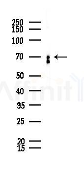 FXR1 Recombinant Rabbit mAb - Western blot analysis of lysates from LoVo cells(heat-shock,45min treatment), using FXR1 Recombinant Rabbit mAb at 1/1000 dilution.