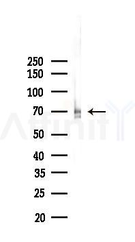 FXR1 Recombinant Rabbit mAb - Western blot analysis of lysates from B16F10-LUC cells(heat-shock,45min treatment), using FXR1 Recombinant Rabbit mAb at 1/1000 dilution.