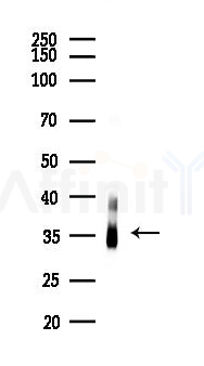 FosB Recombinant Rabbit mAb - Western blot analysis of lysates from Hela cells(LPS,4h treatment), using Fos B Recombinant Rabbit mAb at 1/1000 dilution.
