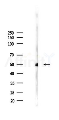 SLC16A1 Recombinant Rabbit mAb - Western blot analysis of lysates from EC304 cells(starvation 24h treatment), using Monocarboxylic Acid Transporter 1 Recombinant Rabbit mAb at 1/1000 dilution.