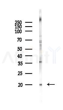 IL7 Recombinant Rabbit mAb - Western blot analysis of lysates from COLO205 cells(heat-shock,45min treatment), using IL-7 Recombinant Rabbit mAb at 1/1000 dilution.