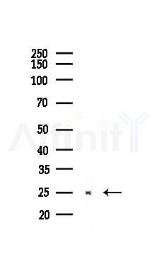 Peroxiredoxin 6 Recombinant Rabbit mAb - Western blot analysis of lysates from Rat kidney, using Peroxiredoxin 6 Recombinant Rabbit mAb at 1/1000 dilution.