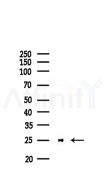 Peroxiredoxin 6 Recombinant Rabbit mAb - Western blot analysis of lysates from COLO205 cells(LPS, 4h treatment), using Peroxiredoxin 6 Recombinant Rabbit mAb at 1/1000 dilution.
