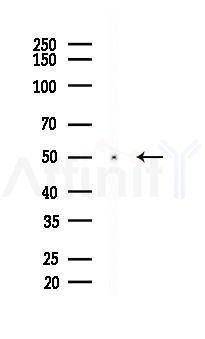 DGAT1 Recombinant Rabbit mAb - Western blot analysis of lysates from A2780 cells(UV 30min treatment), using DGAT1 Recombinant Rabbit mAb at 1/1000 dilution.