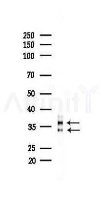Stanniocalcin 2 Recombinant Rabbit mAb - Western blot analysis of lysates from HUVEC cells(LPS,4h treatment), using Stanniocalcin 2/STC-2 Recombinant Rabbit mAb at 1/1000 dilution.